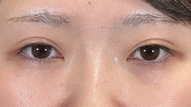 手术前的状态 其一