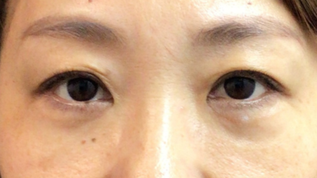 Postoperative Condition Part 1