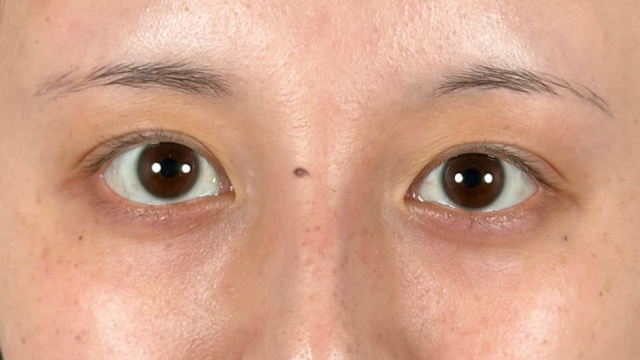 手术前的状态 其一