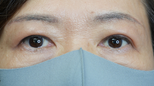 Postoperative Condition Part 1