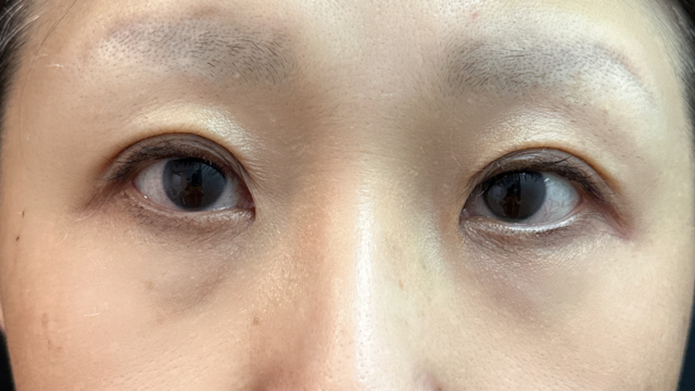 Postoperative Condition Part 1