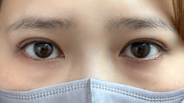 手术前的状态 其一