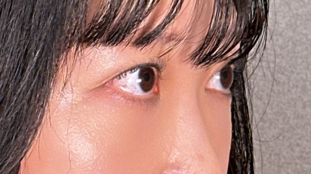 手术前的状态 其一