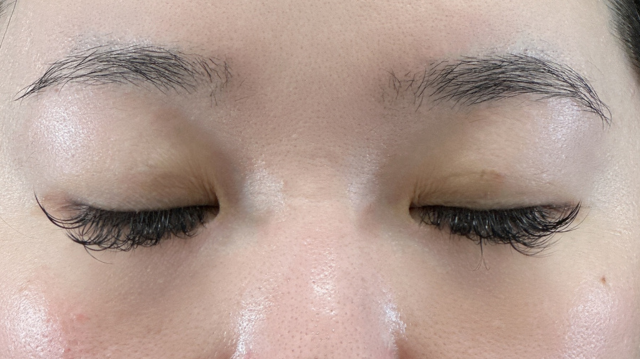 Postoperative Condition Part 1