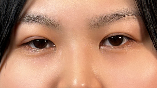 手术前的状态 其一