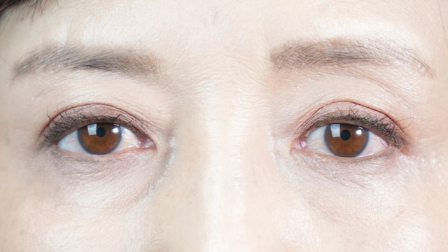 手術前の状態 その1