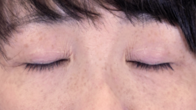 手术前的状态 其一