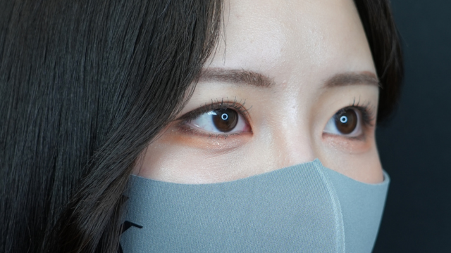 手术前的状态 其一