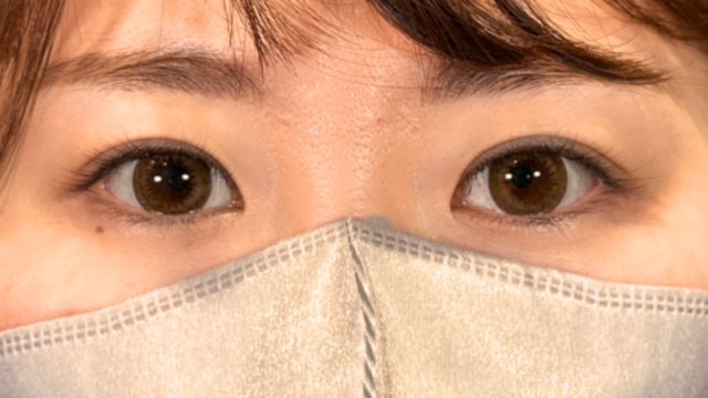 手术前的状态 其一