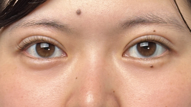 手术前的状态 其一