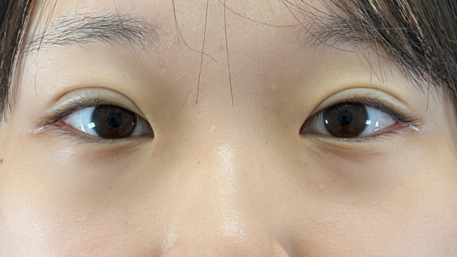 手术前的状态 其一