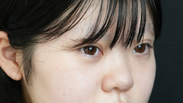 手术前的状态 其一