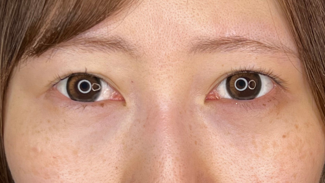 手术前的状态 其一