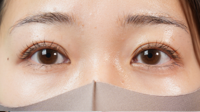 手術前の状態 その1