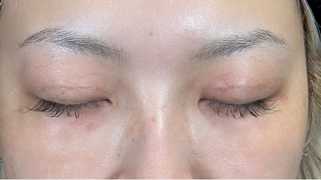 手术前的状态 其一