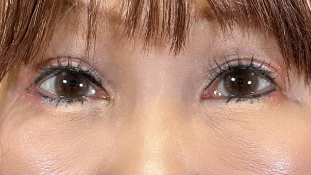 手术前的状态 其一