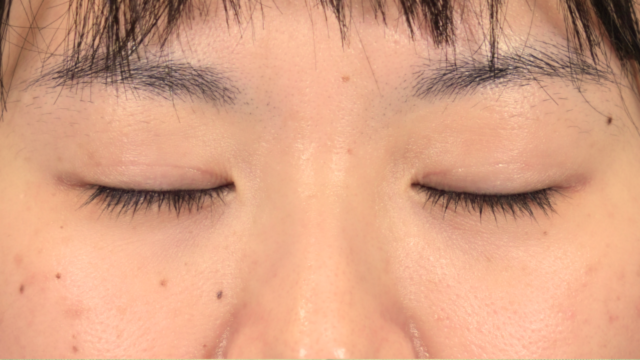 Postoperative Condition Part 1