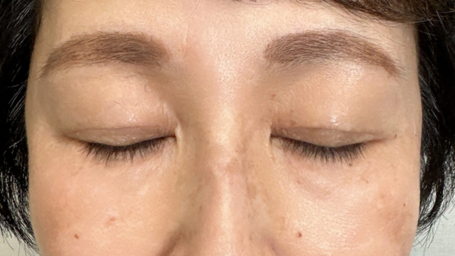 手术前的状态 其一