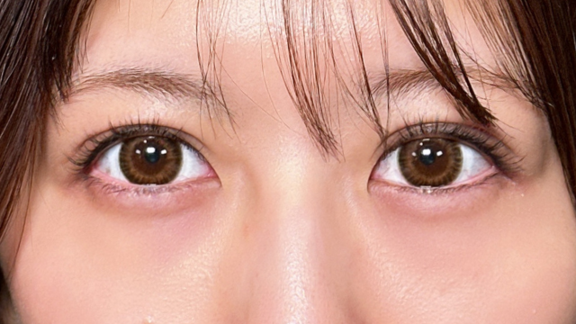 手术前的状态 其一