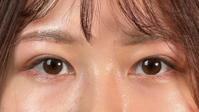 Postoperative Condition Part 1