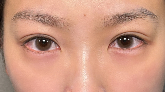 手术前的状态 其一