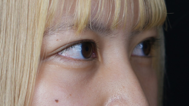 手術前の状態 その1