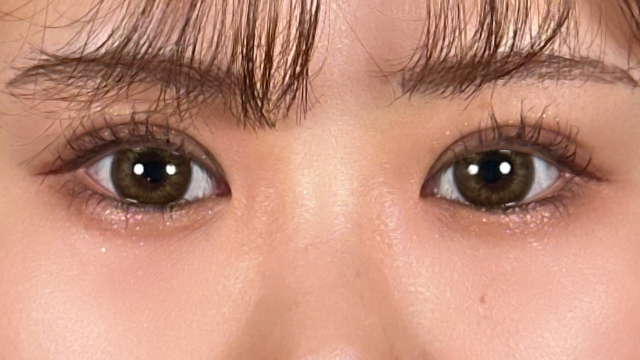 手术前的状态 其一