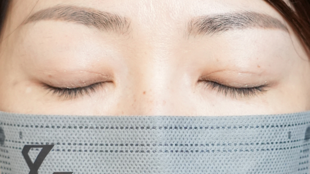 手术前的状态 其一