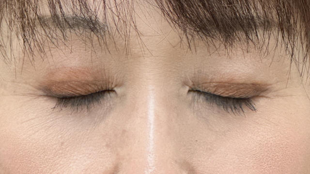 手术前的状态 其一