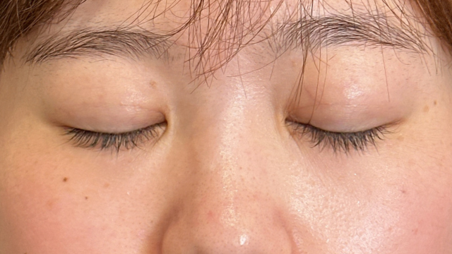 Postoperative Condition Part 1