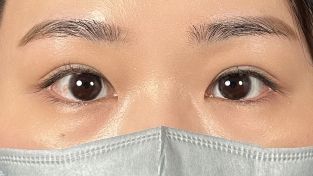 手術前の状態 その1