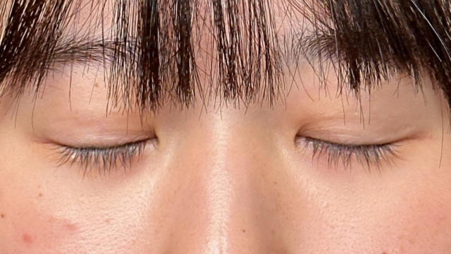 手术前的状态 其一