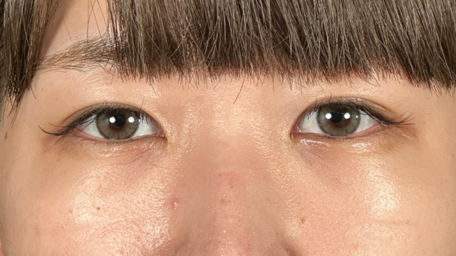 手术前的状态 其一