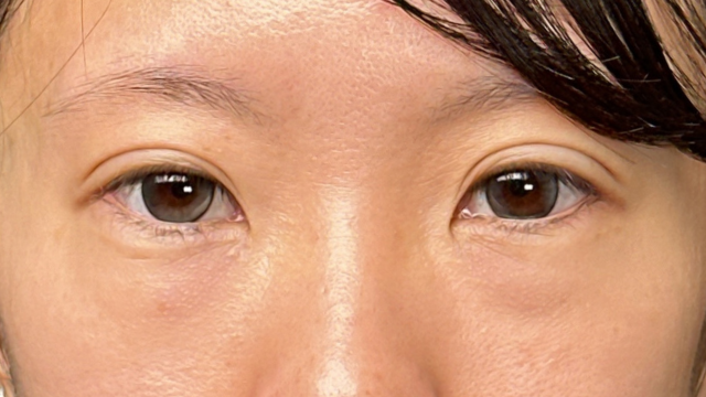 手术前的状态 其一