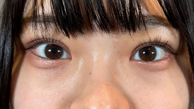 手术前的状态 其一