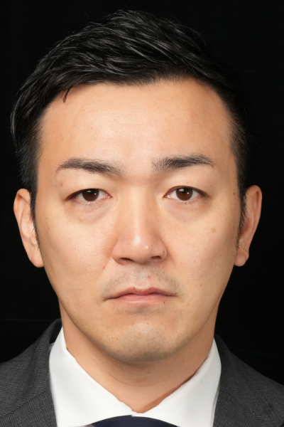 手術前の状態 その1