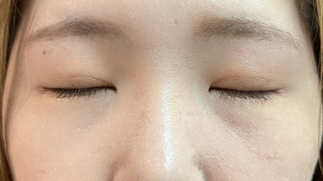 Postoperative Condition Part 1