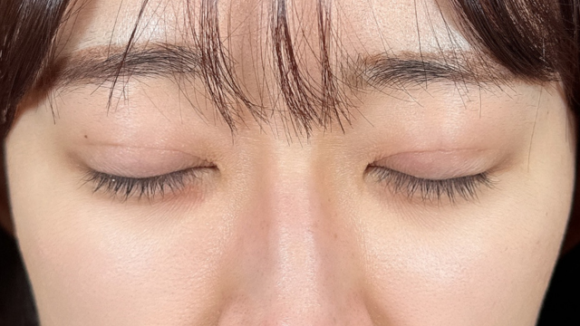 手术前的状态 其一