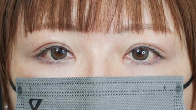 手术前的状态 其一