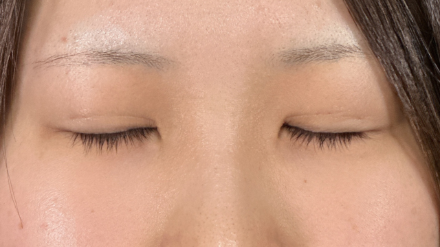 手术前的状态 其一