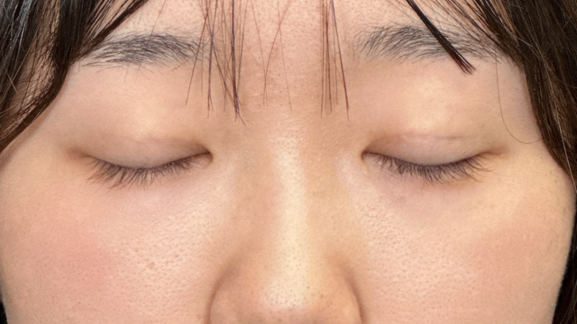 Postoperative Condition Part 1