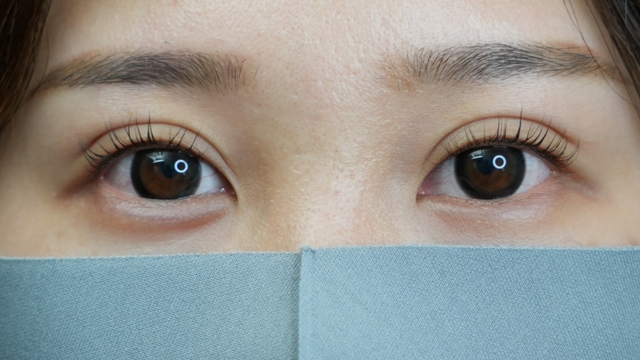 手術前の状態 その1