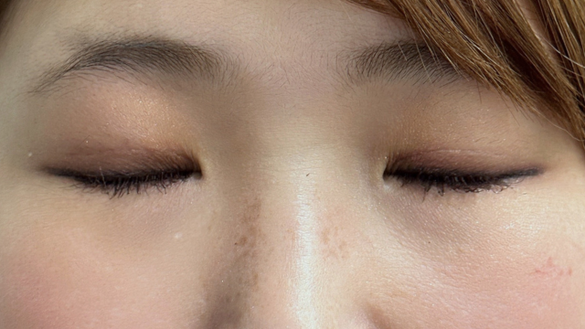 Postoperative Condition Part 1