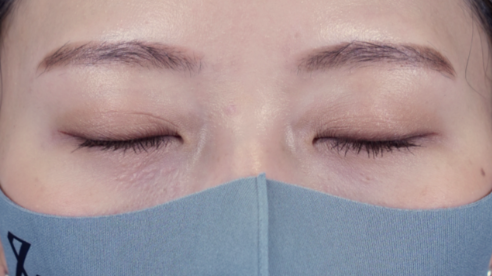 手术前的状态 其一