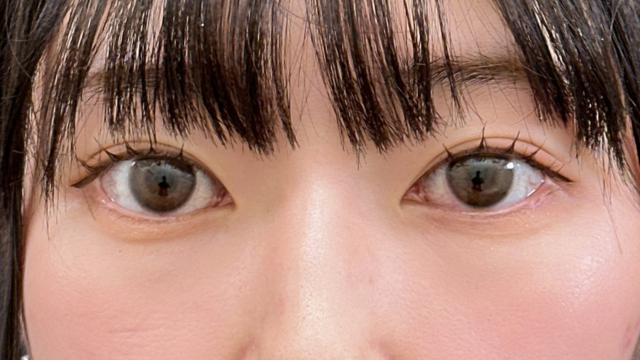 手術前の状態 その1