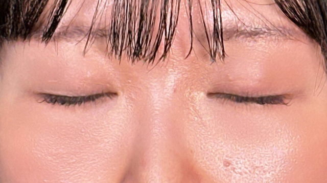 手术前的状态 其一