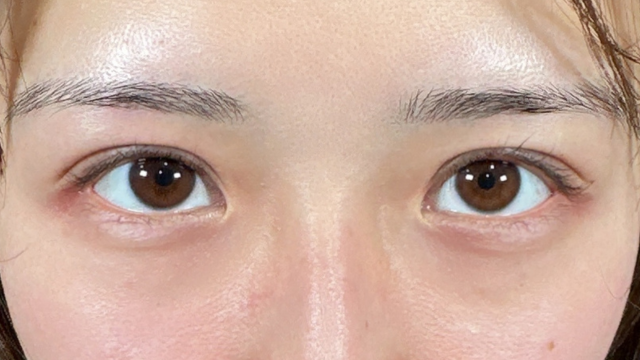 手术前的状态 其一