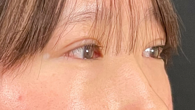 Postoperative Condition Part 1