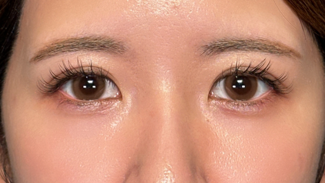 手术前的状态 其一