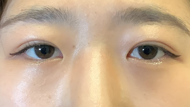 Postoperative Condition Part 1